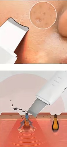 Espátula ultrasónica facial